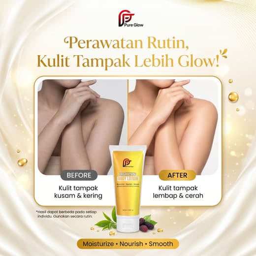 Ilustrasi sebelum & sesudah rutin memakai Body Lotion